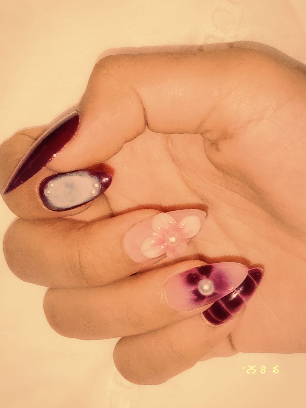 3D NAIL