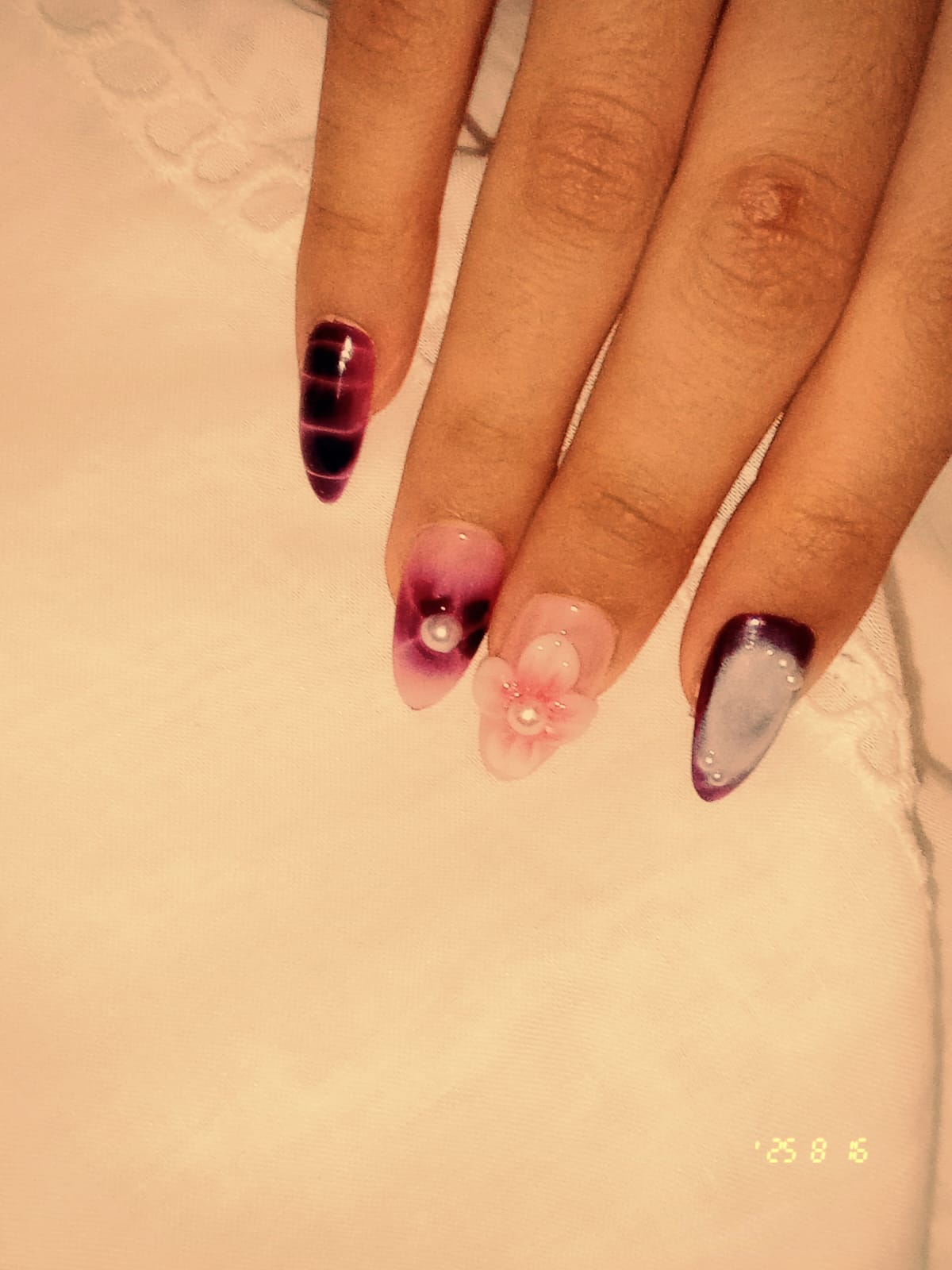 3D NAIL